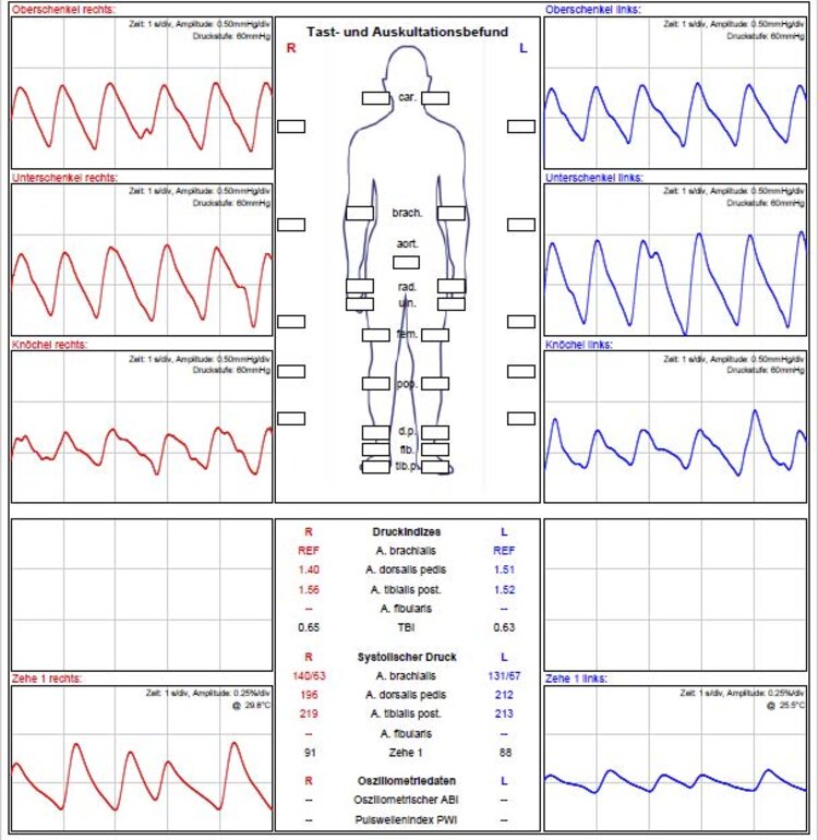 Hier können im Seitenvergleich die Pulskurven an Oberschenkel, Unterschenkel, Knöcheln und Grosszehe gemessen und evtl. Strombahnhindernisse festgestellt werden.